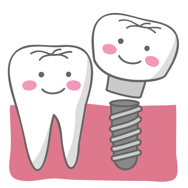 Dentist's Direct] Points on Choosing a Dentist - Implants