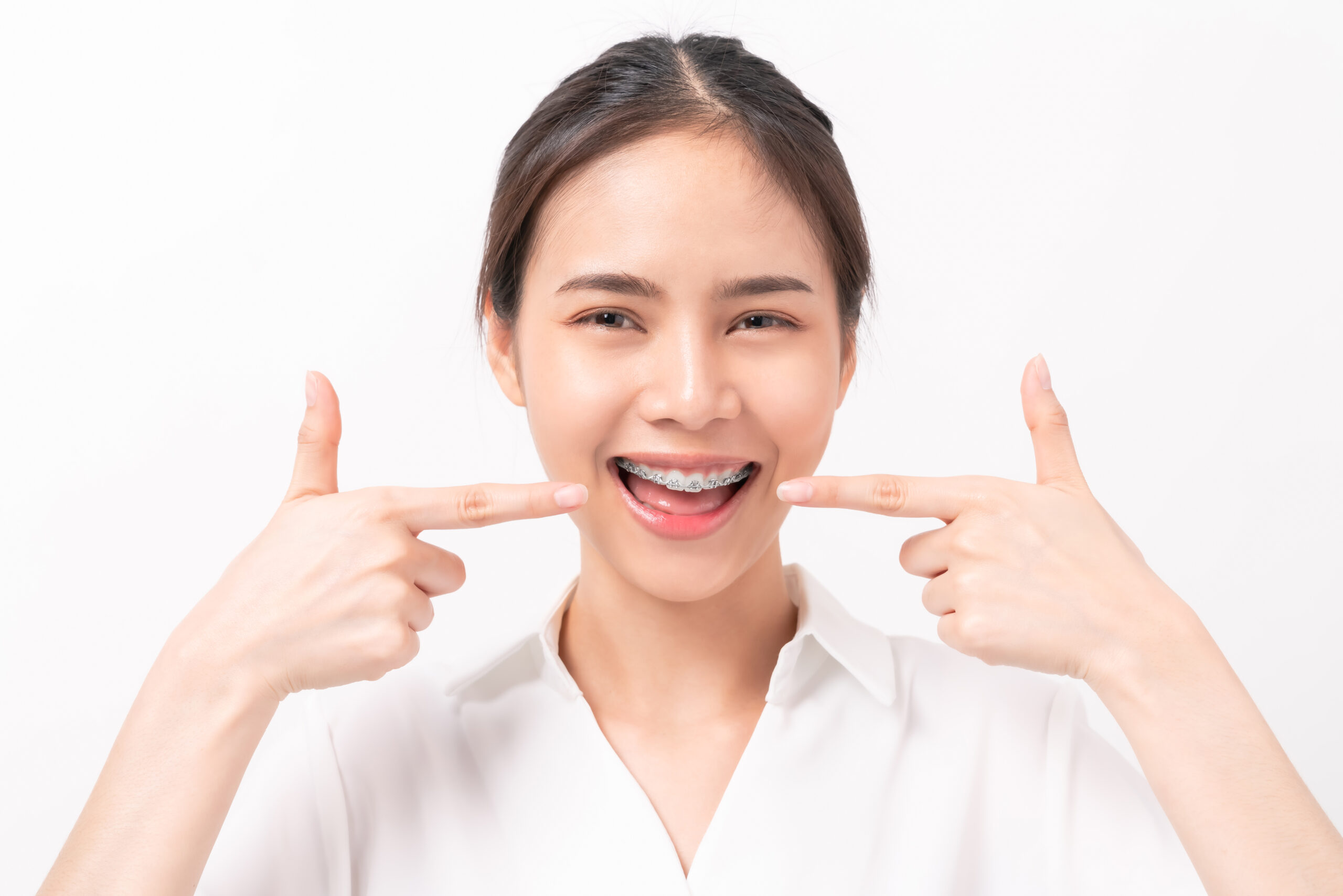 What is the cost of adult orthodontics? Price quotes and cost breakdown for different types of adult orthodontics!