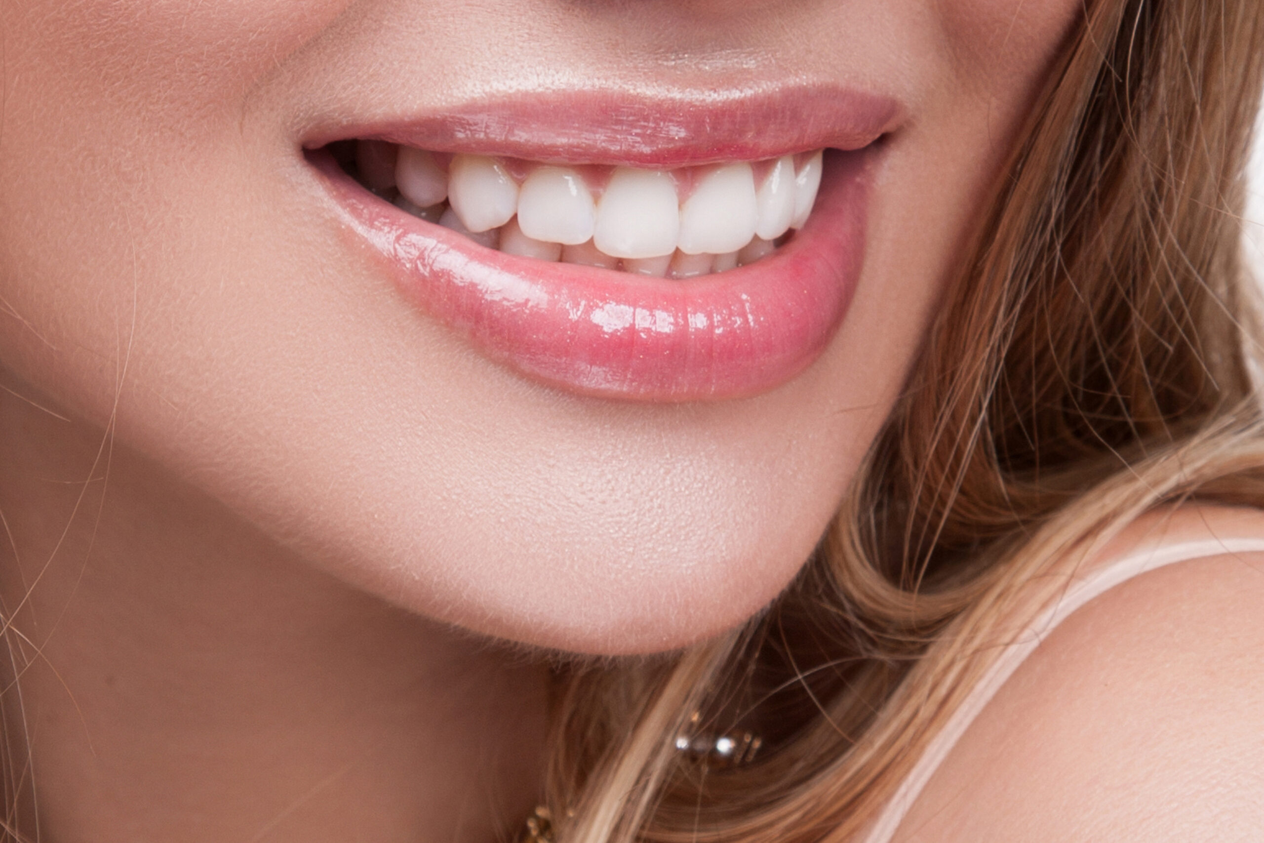 Can your teeth be partially straightened? Or not?