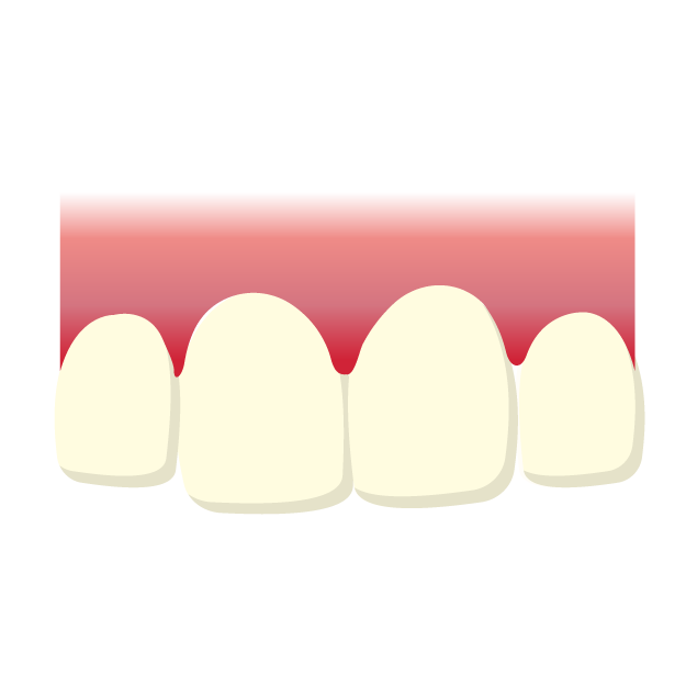 Do large front teeth require orthodontics?