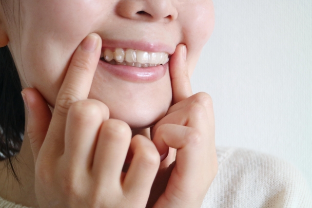 Is Overbite Cute? Why you should treat it.