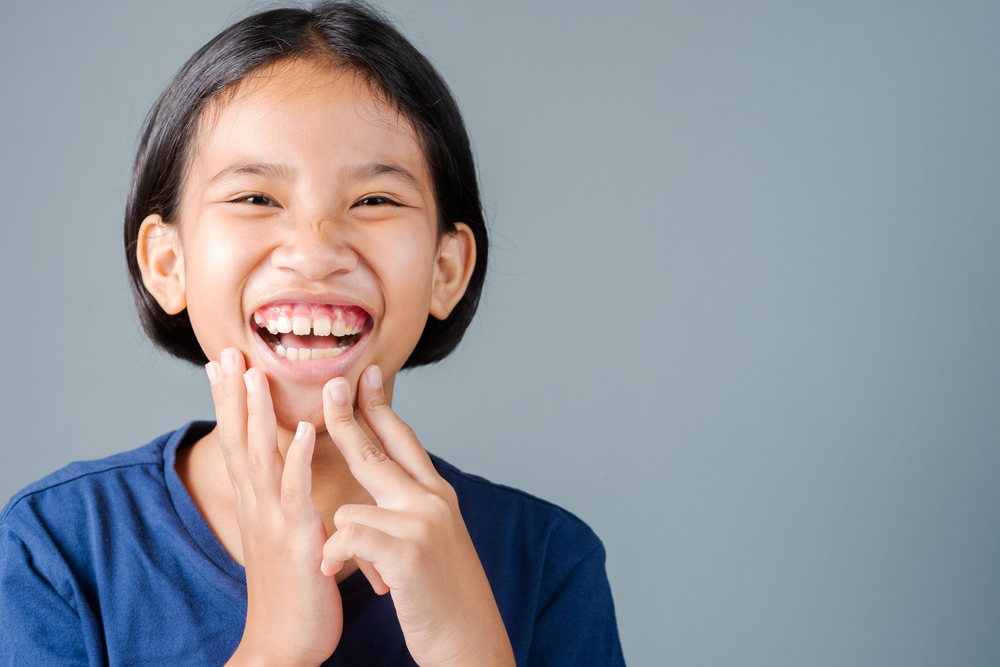 Can a gummy smile be treated with orthodontics?