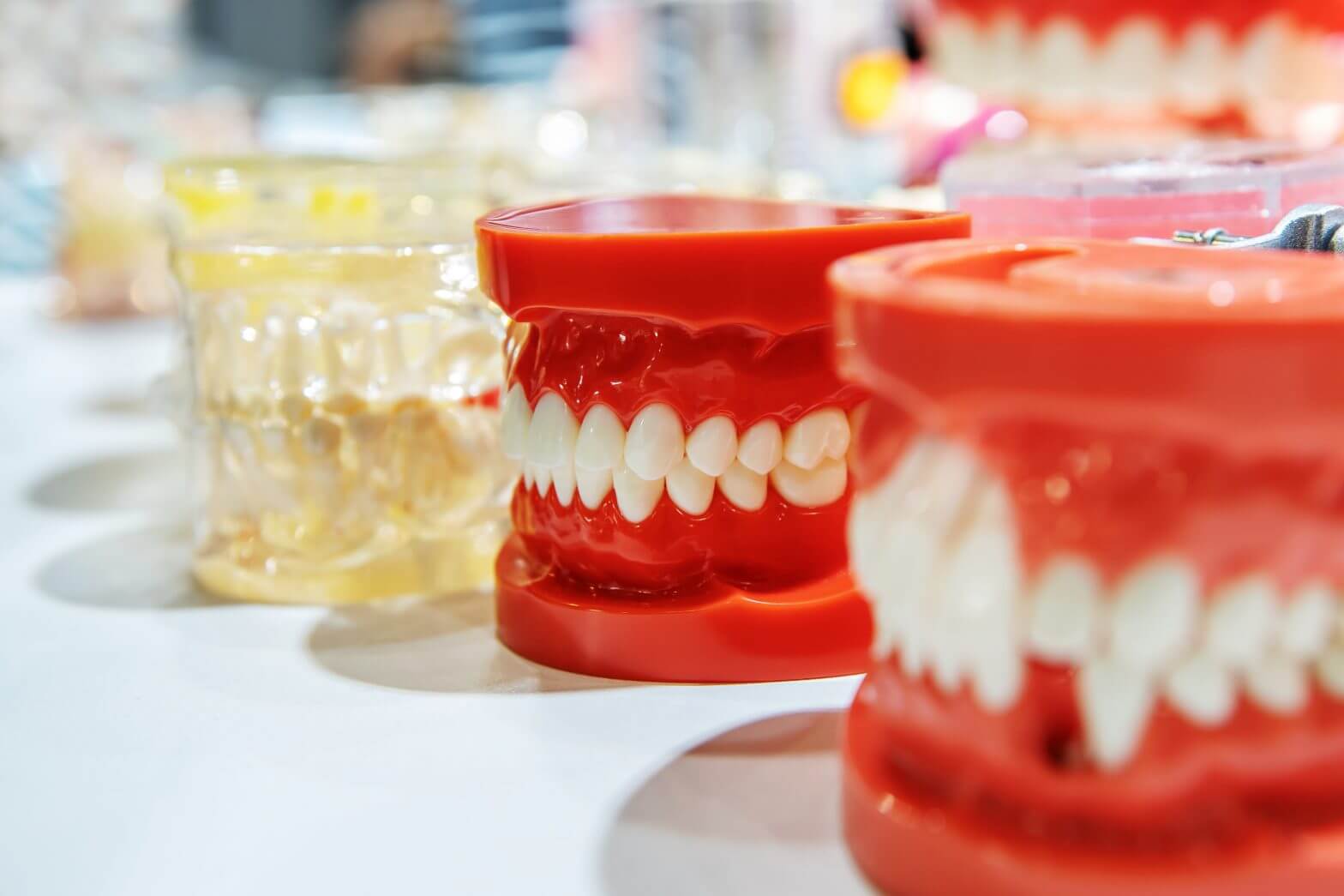 What is the difference between implants, bridges and dentures? Gently explained.