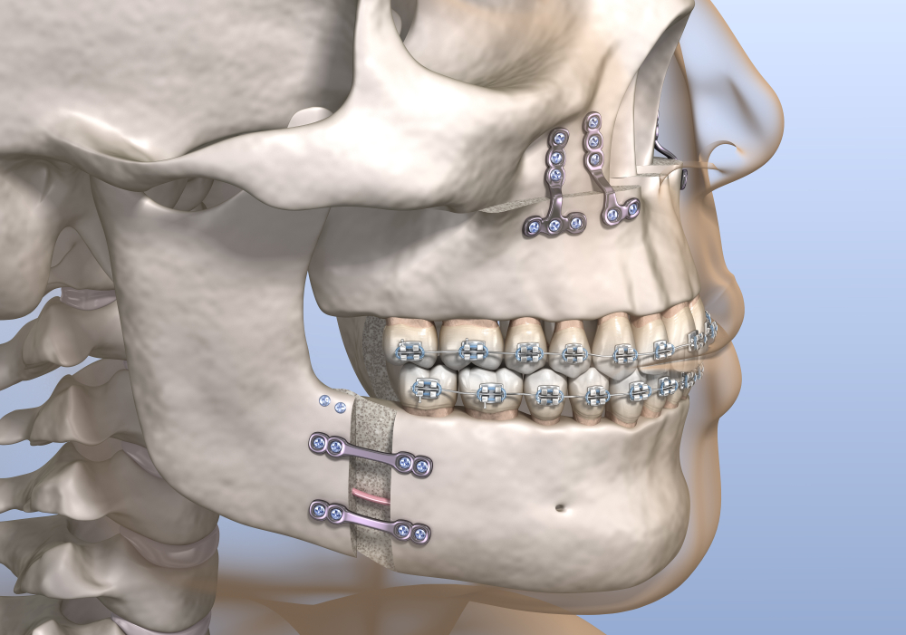 Dentist's Commentary] To Avoid Regrets in Jaw Deformity Treatment! Explains the cost, length of hospital stay, and flow of treatment!