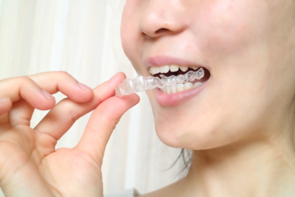 Advantages and disadvantages of orthodontics in the 40s and 50s that you should know about.