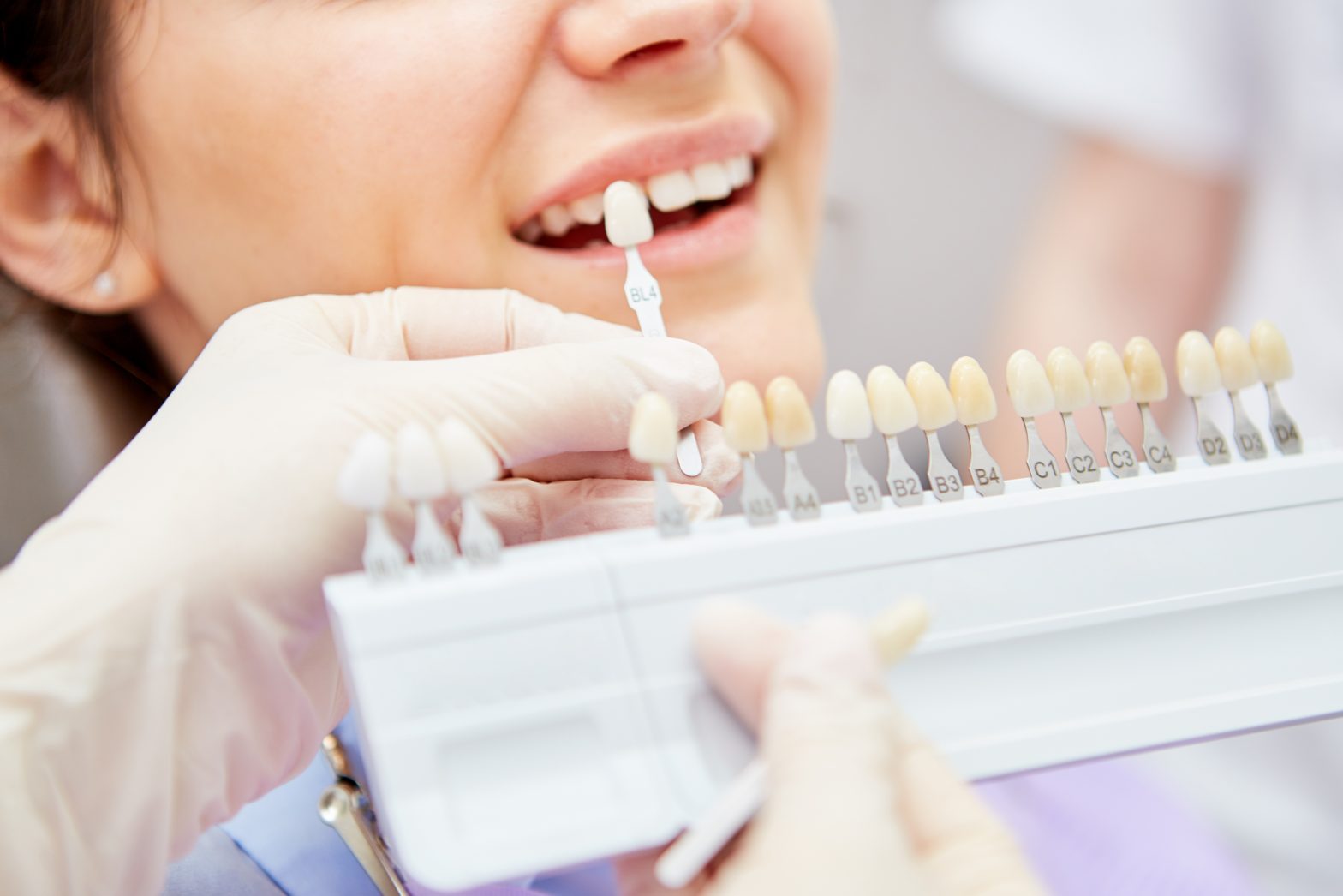 How effective is whitening? Explains the number of times and duration required for each type!