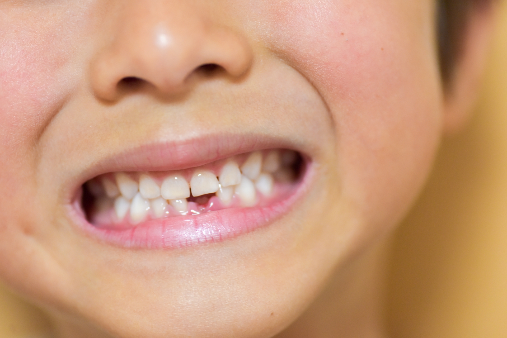 When do baby teeth come in? A dentist explains the order and age at which they fall out!