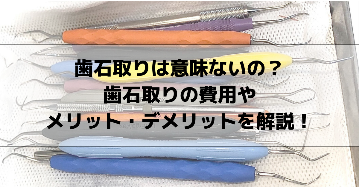 歯石取りは意味ないの?歯石取りの費用やメリット・デメリットを解説! - 365 Dentist