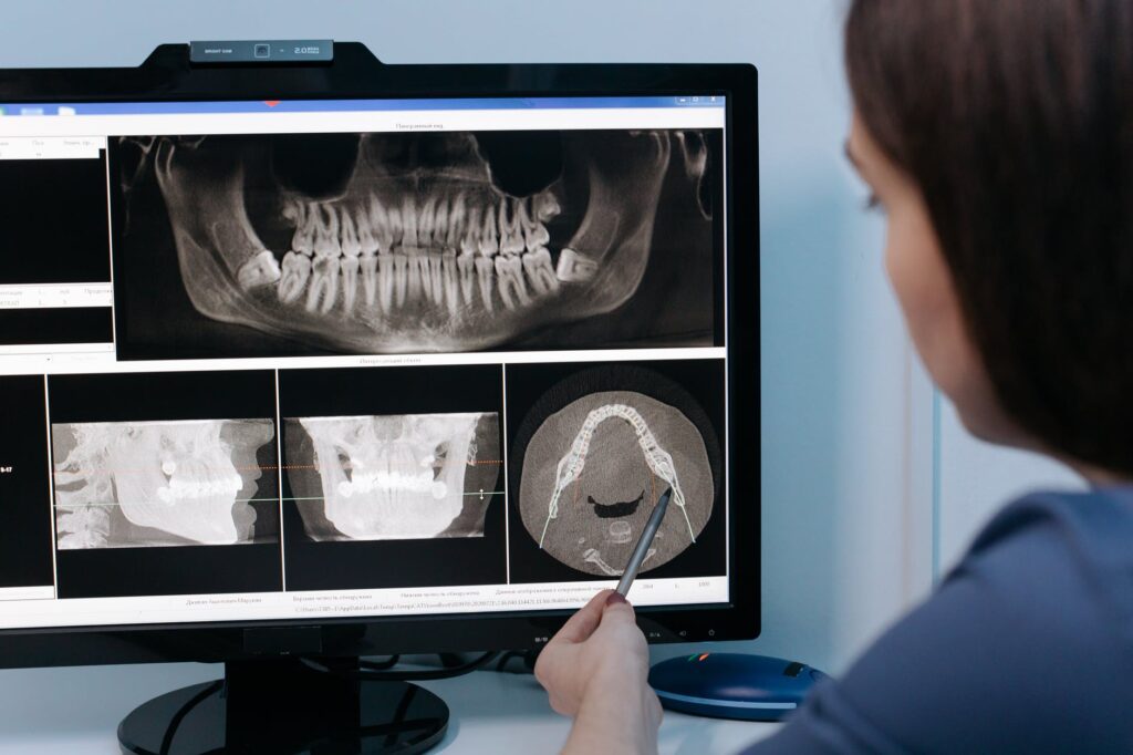 X-ray radiation dose