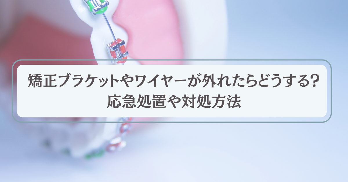 矯正ブラケットやワイヤーが外れたらどうする？応急処置や対処方法