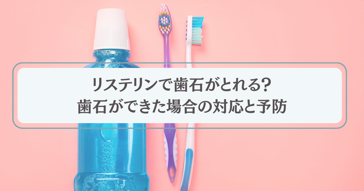 リステリンで歯石がとれる？歯石ができた場合の対応と予防