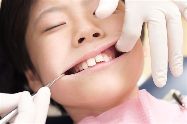 Childhood orthodontic treatment, first stage treatment, stop.