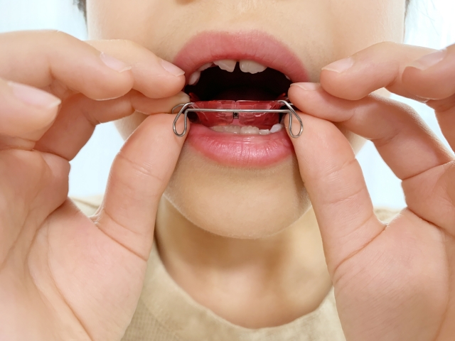 Children's orthodontic treatment from when