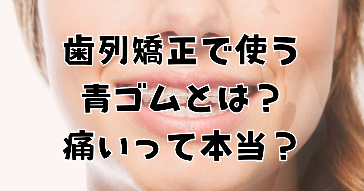 歯列矯正で使う青ゴムとは？痛いって本当？