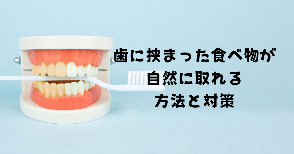 歯に挟まった食べ物が自然に取れる方法と対策～安全で効果的なケアの秘訣